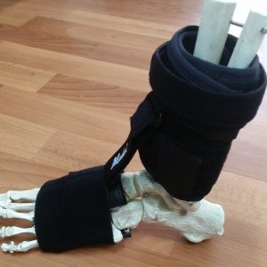 דיקטוס לצניחת כף רגל